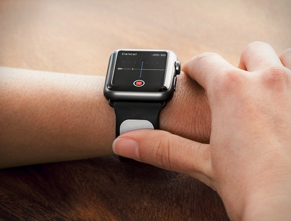 Кардиобраслет Kardia для Apple Watch